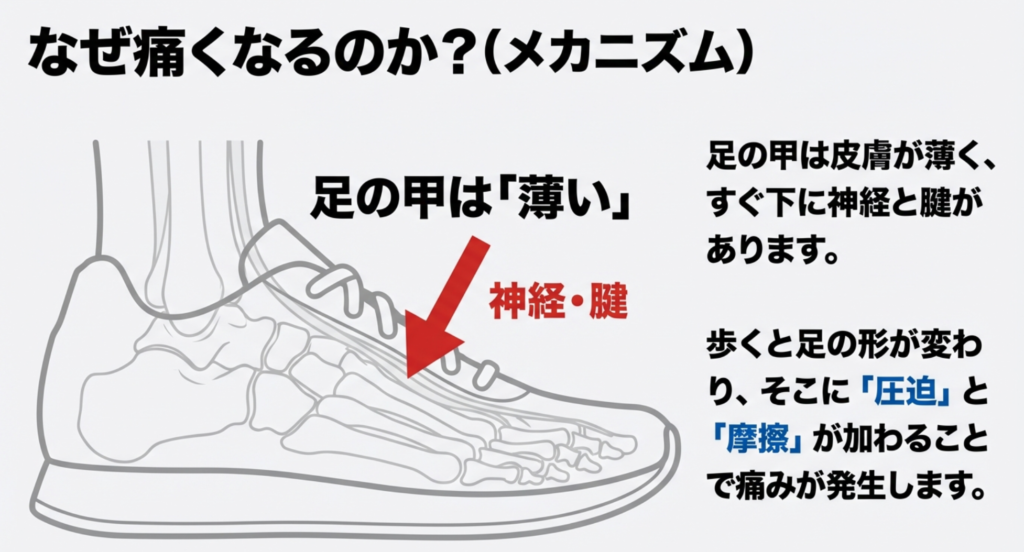 足の甲の皮膚が薄く、すぐ下に神経と腱が通っていることを示す解剖図のイラスト